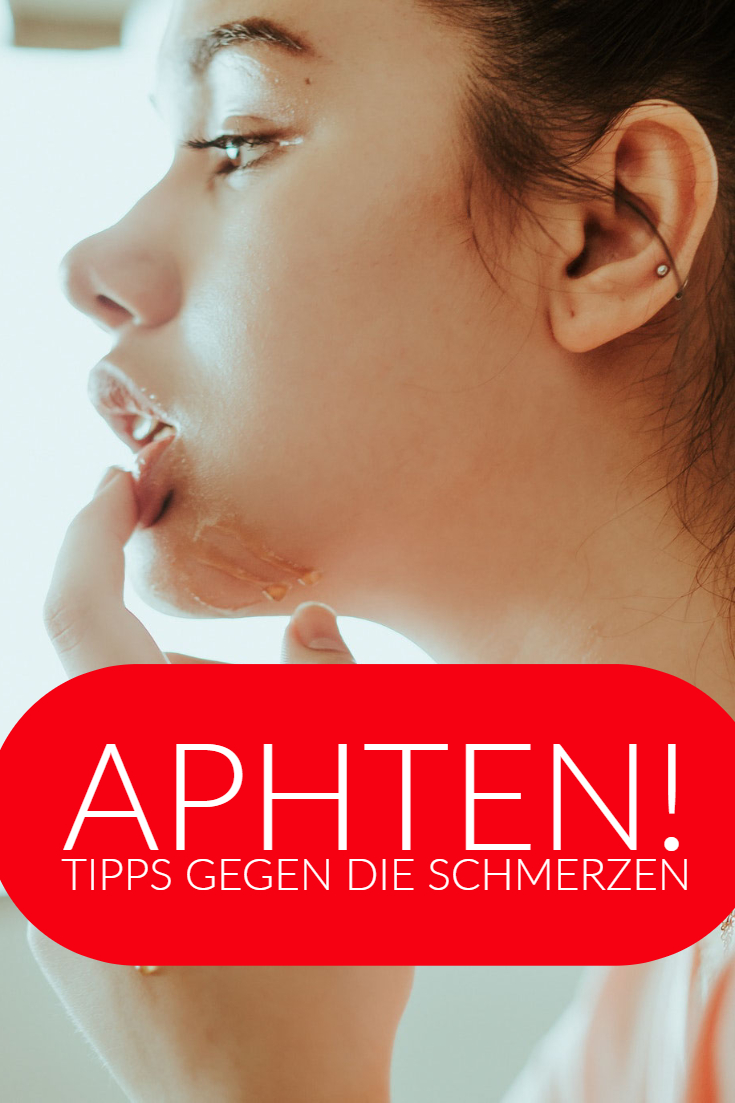 Was du gegen Aphten tun kannst Das InspirationsMagazin