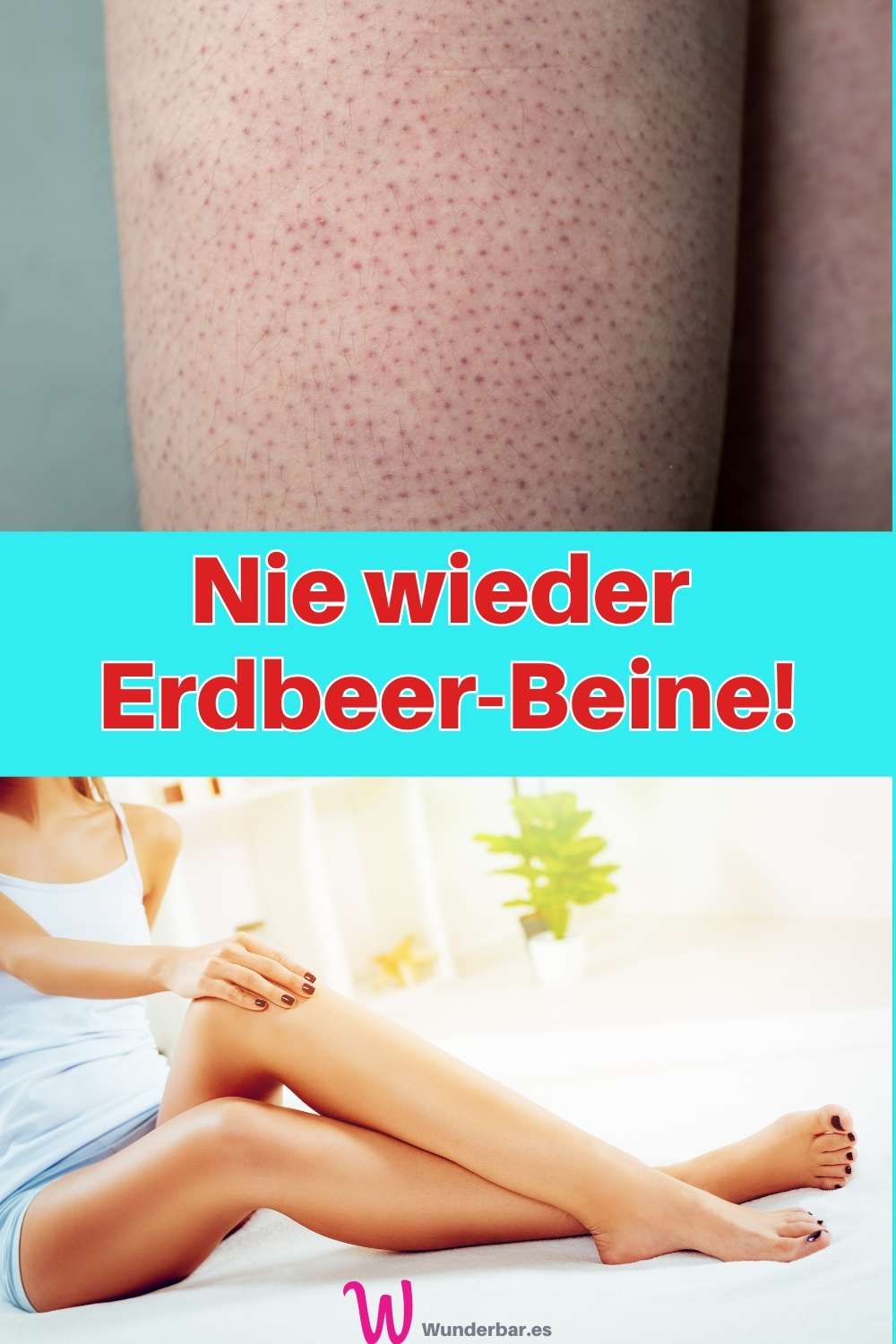 Was Kann Ich Gegen Erdbeerbeine Tun Erdbeerbeine vermeiden | Pünktchen nach der Rasur vorbeugen