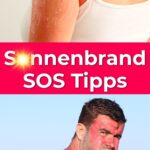 Wohltuende Tipps bei Sonnenbrand